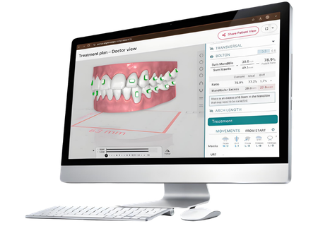 Dental aligner tray